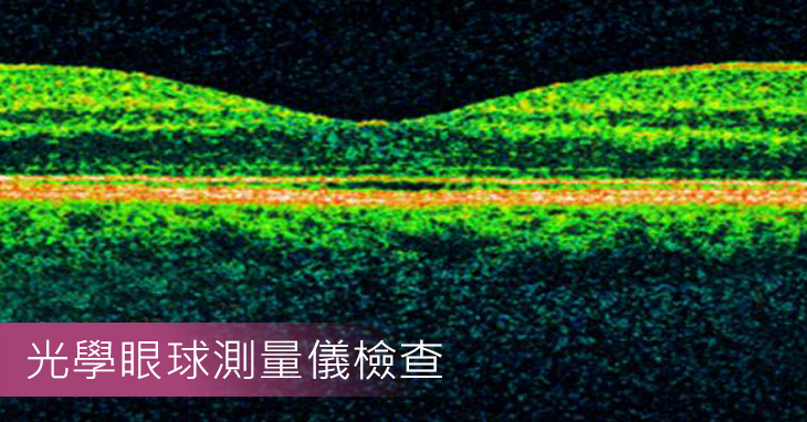 光學同調斷層掃描