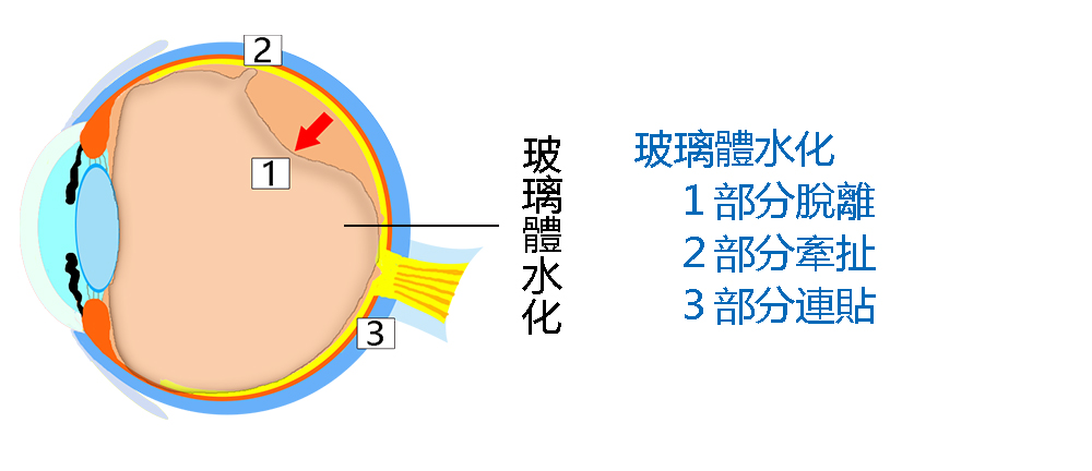 水化