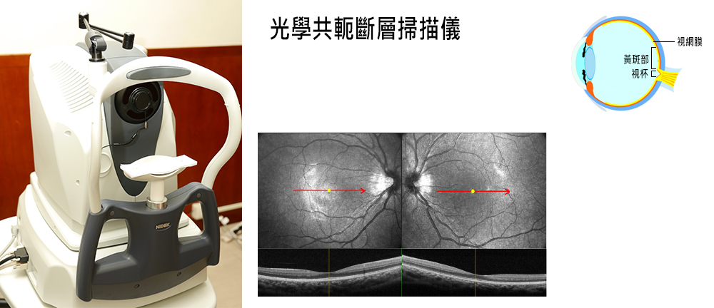 光學共軛斷層掃描儀