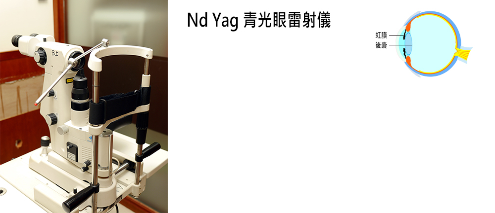 Nd Yag 青光眼雷射儀